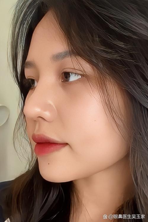 什么是短鼻子