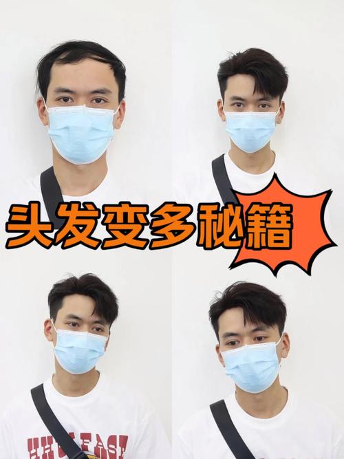 脱发什么发型