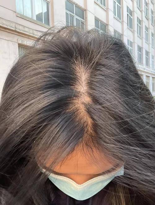 脱发什么发型
