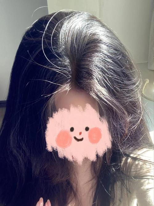 脱发什么发型