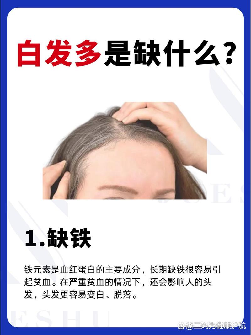 白头发是什么原因引起的