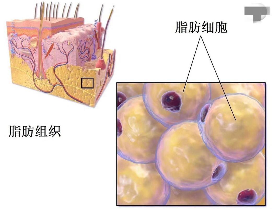 脂肪是什么样子的图片