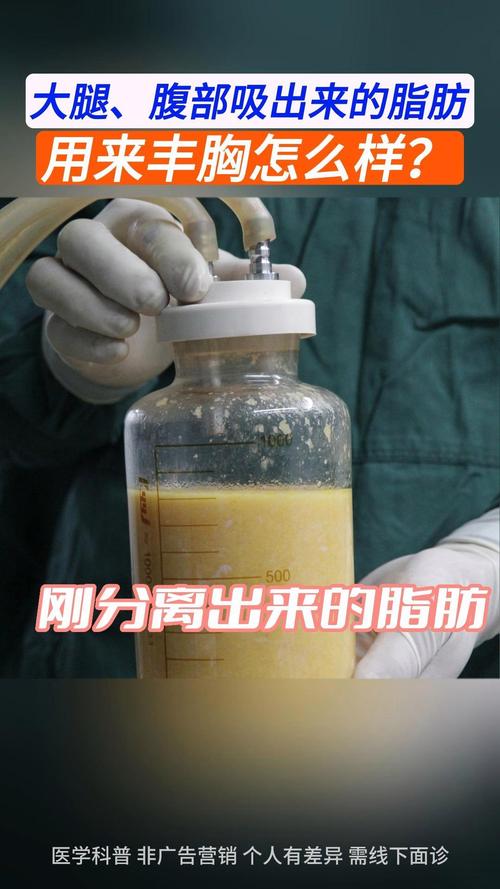 脂肪是什么样子的图片