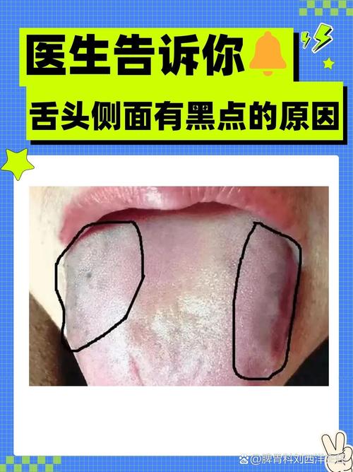 舌头发木是什么原因