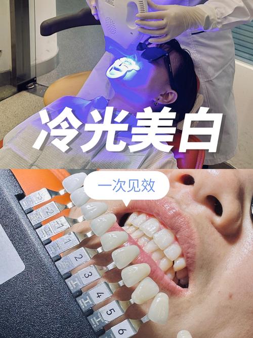 叫光什么美白减肥的