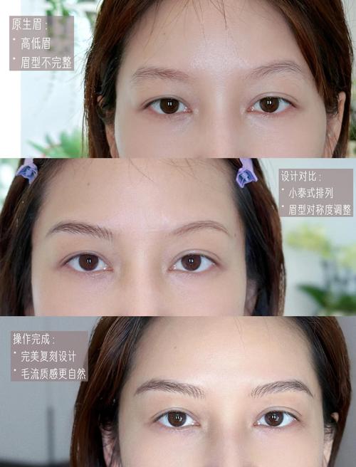为什么会高低眉