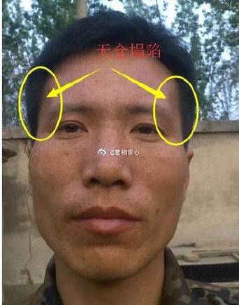 什么是天庭饱满