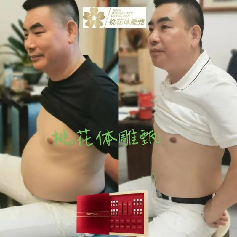 什么叫体雕减肥