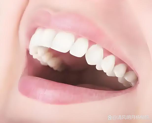 什么是美容牙