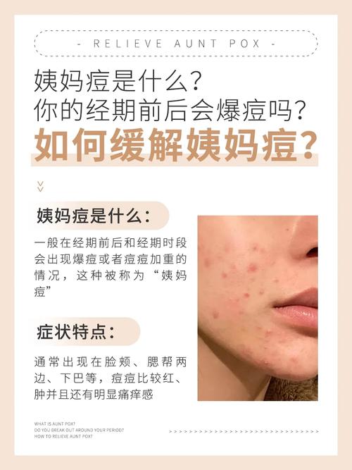 生理期为什么长痘痘