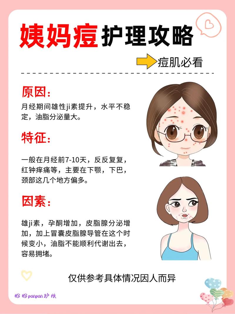 生理期为什么长痘痘