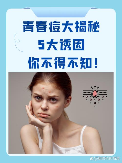 为什么要长青春痘