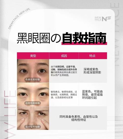 黑眼圈重是为什么