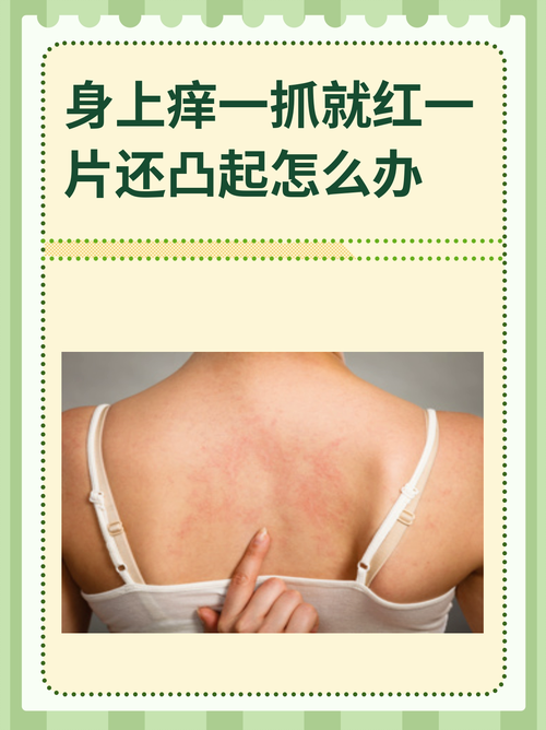 皮肤发红发痒什么原因