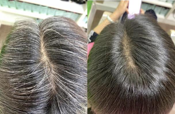 什么人不能染头发