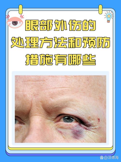 开眼角有什么危害