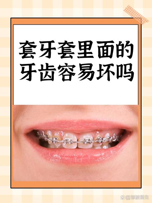 为什么要牙套