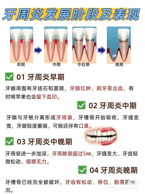 牙周炎有什么危害