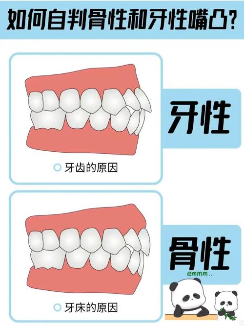 龅牙为什么