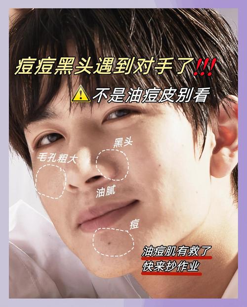 用的洗面奶脸上长痘痘怎么回事