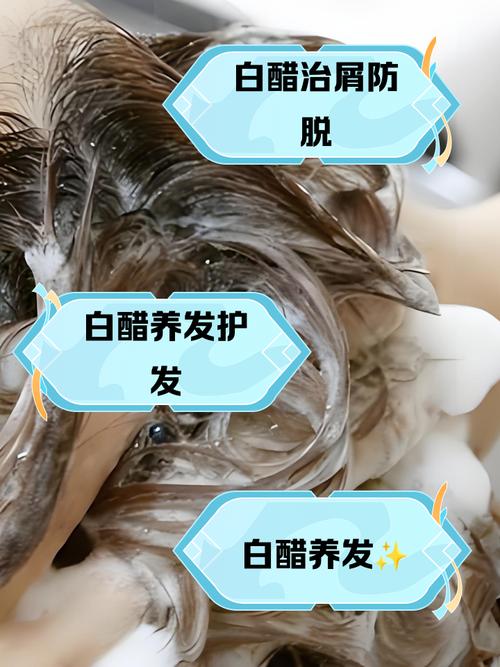 醋洗头发有什么好处
