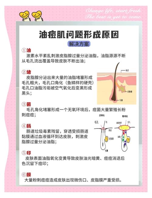 用洗面奶洗脸怎么长痘痘怎么回事