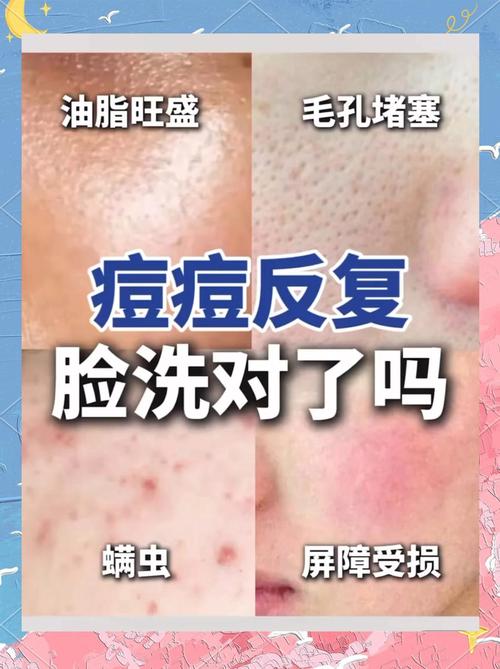 用洗面奶洗脸怎么长痘痘了