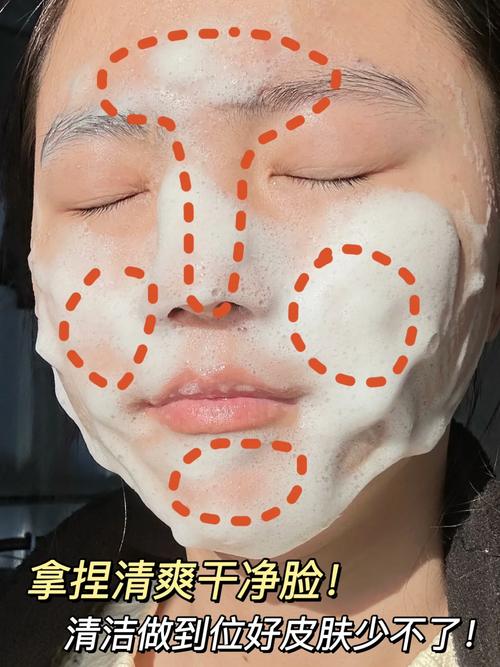用洗面奶洗脸怎么长痘痘了