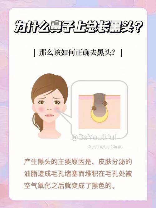 为什么会有黑鼻头