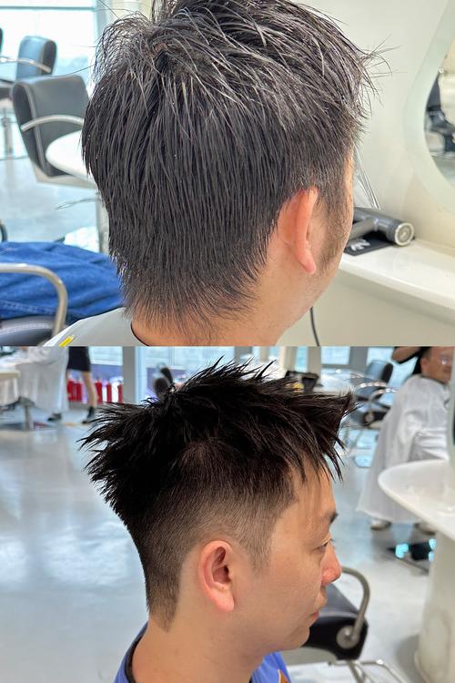 什么是秃鬓