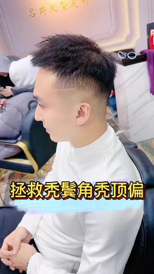 什么是秃鬓