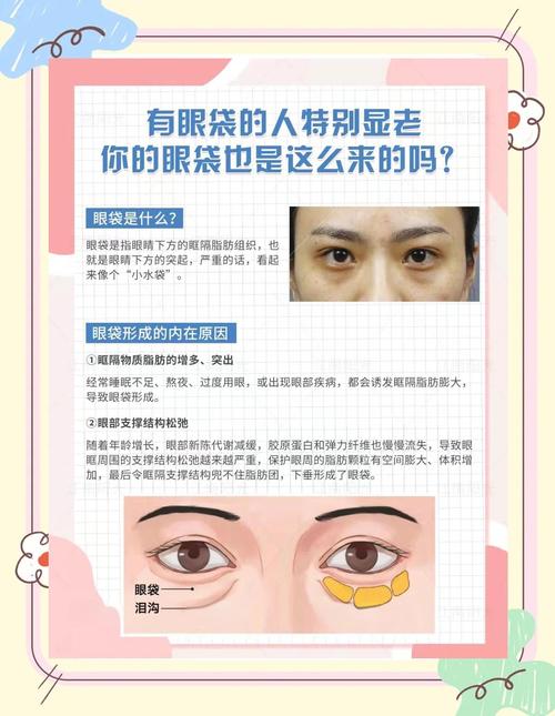 为什么眼袋很大
