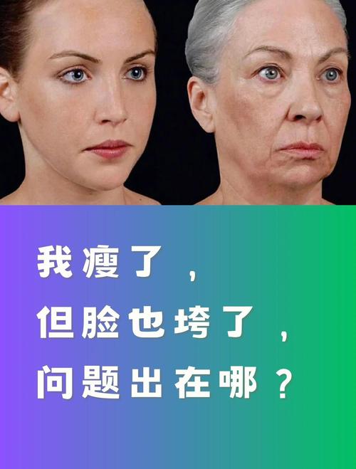 为什么减肥脸不瘦
