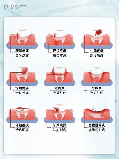 大牙疼痛是什么原因