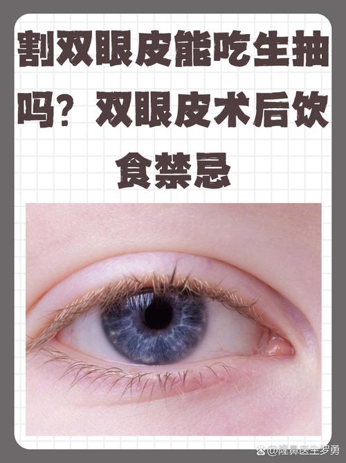 割双眼皮忌什么