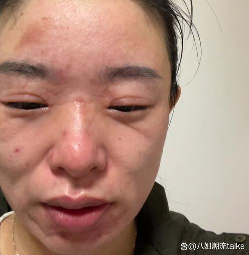 频繁敷面膜会怎么样