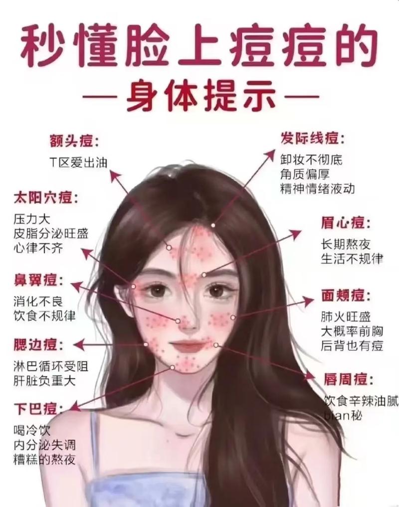身上长粉刺什么原因