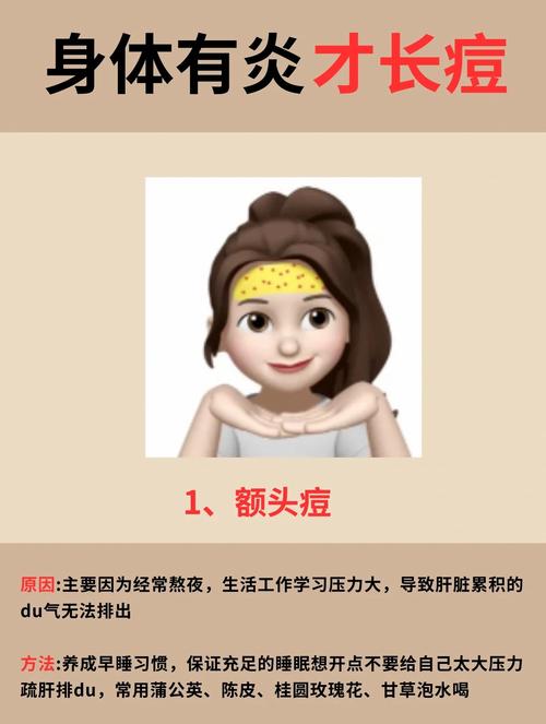 额头长痘痘是为什么