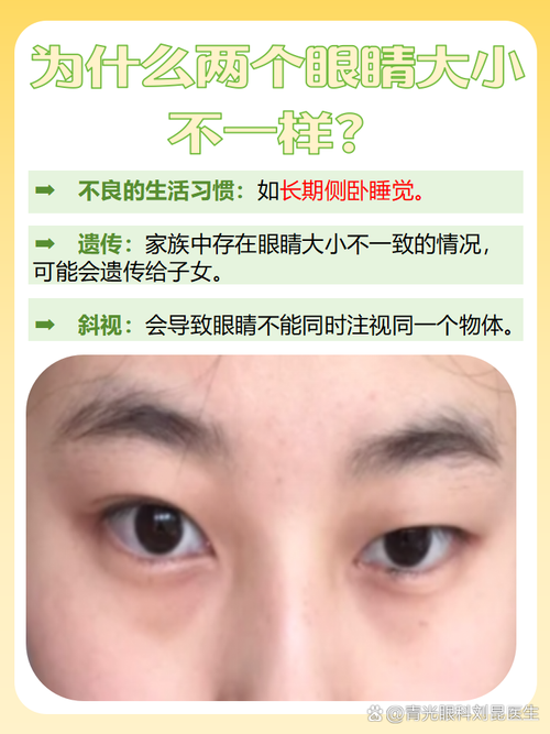 为什么左眼大右眼小