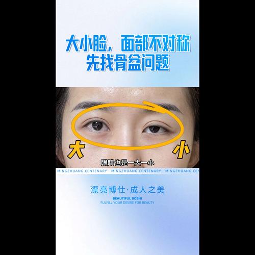 为什么左眼大右眼小