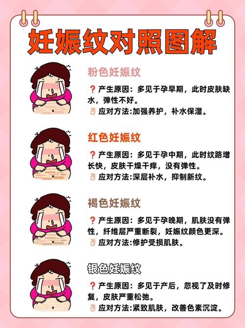 妊娠纹有什么危害