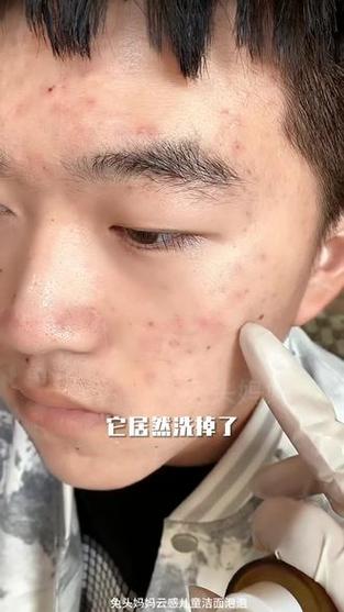 没有洗面奶的时候怎么洗脸