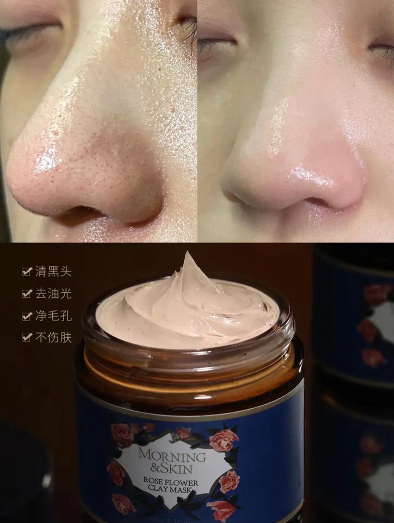 玫滋医用修复面膜怎么样