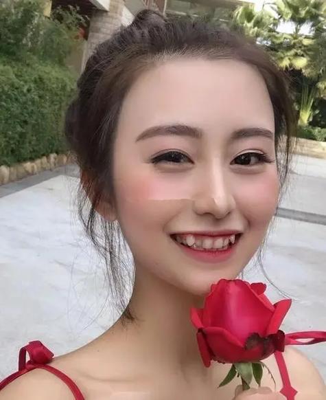 人为什么有虎牙