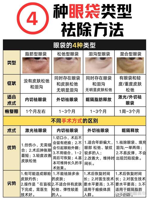 眼袋大是为什么