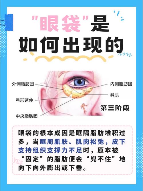 眼袋大是为什么