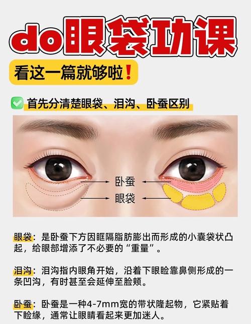用什么消除眼袋