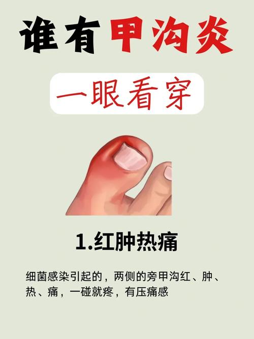 什么原因引起甲沟炎