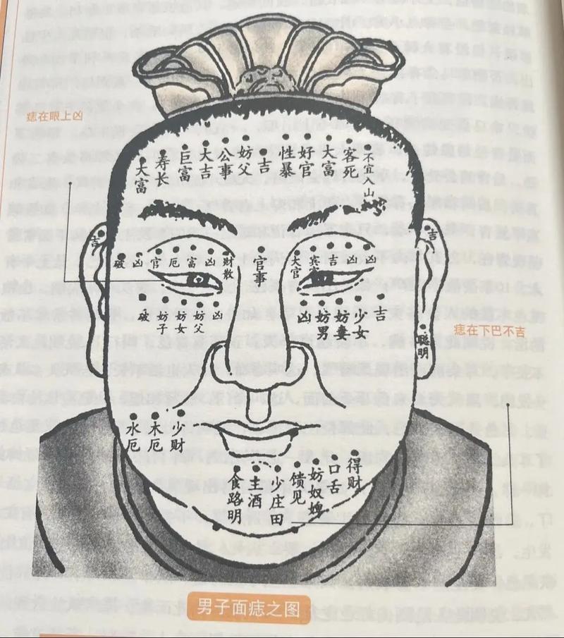 脸上为什么老长痣