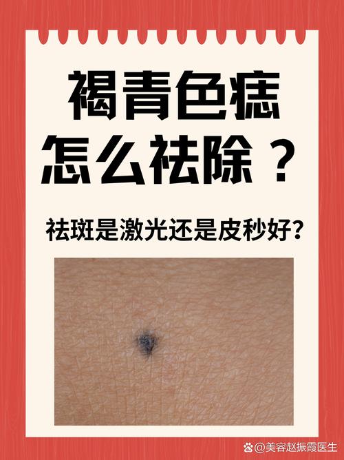 色素沉着是什么颜色